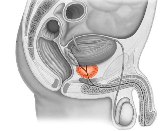 Vospalenie of the prostate