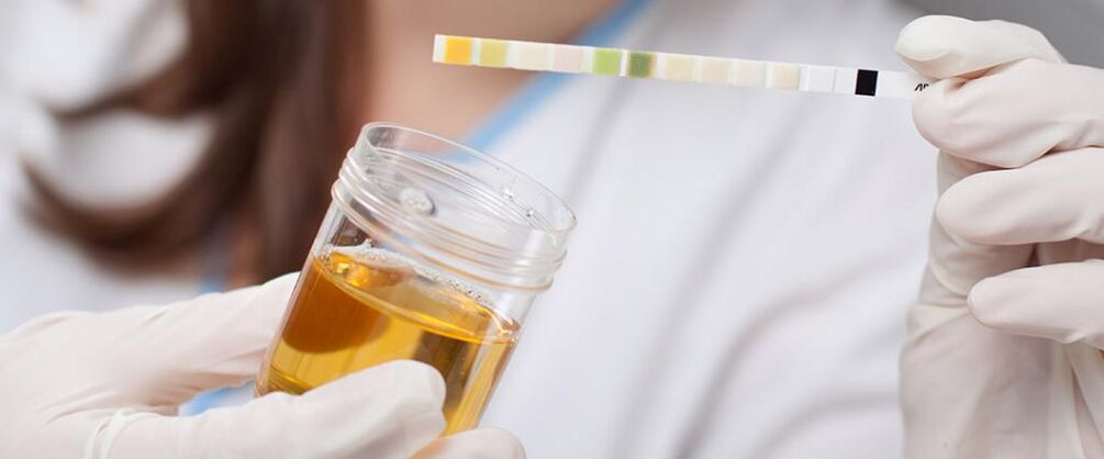 urinalysis for prostatitis