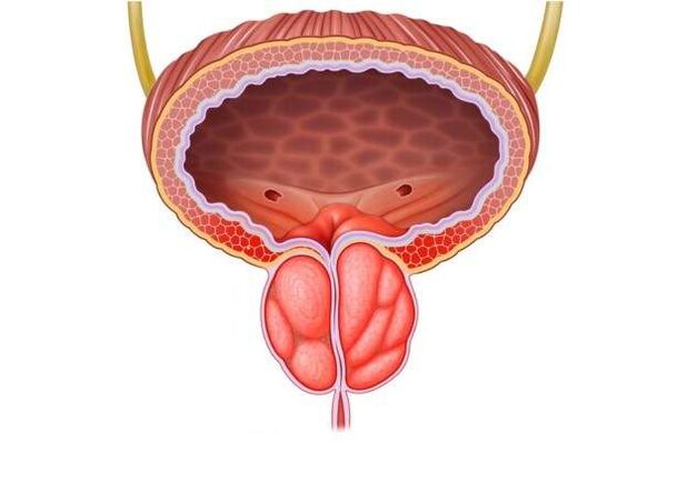 treatment of prostatitis in men